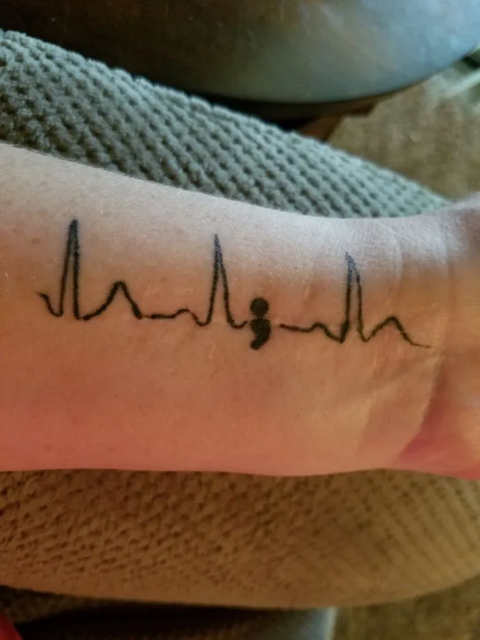 Tattoo of an EKG heartbeat line with a semicolon transforming a scar into art on a forearm.