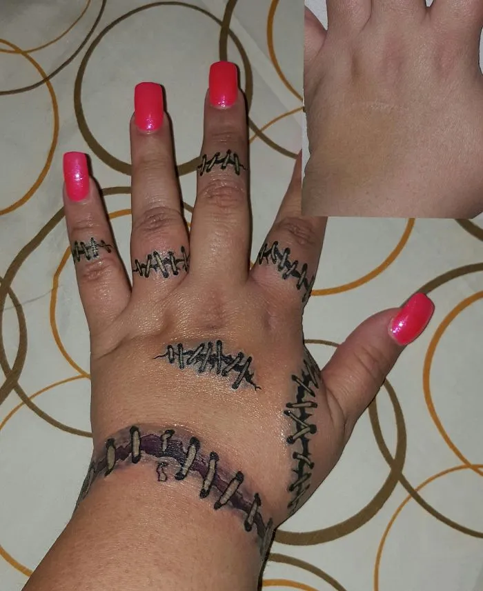 Tattoo turns hand scar into art, stitches design on fingers and wrist, vibrant pink nails enhance the look.