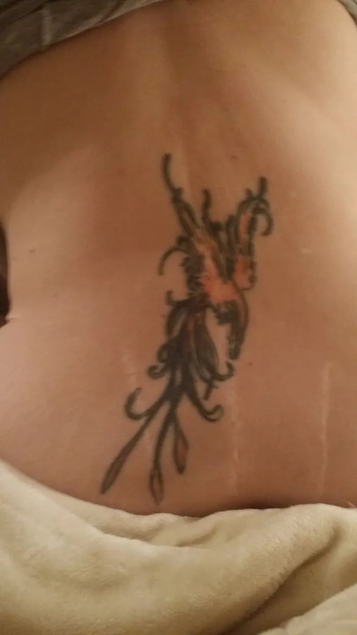 Tattoo designs creatively transforming scars into art on lower back.
