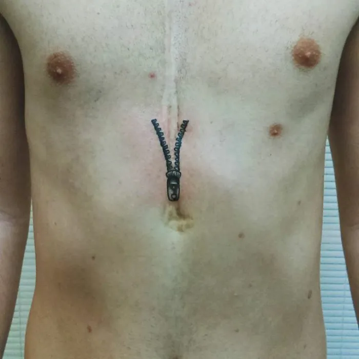 Zipper tattoo on a chest scar turning it into a work of art.