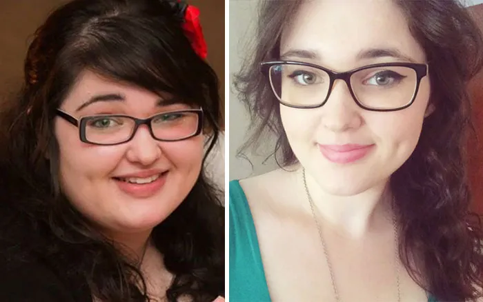 Mi cara con 60 kilos menos