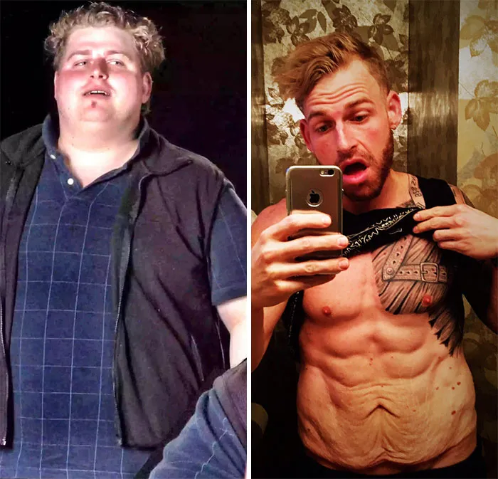 Before And After Weight Loss