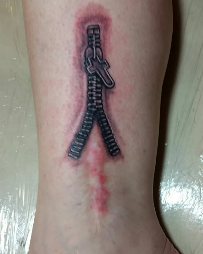 Zipper tattoo art creatively transforming a scar on the skin.