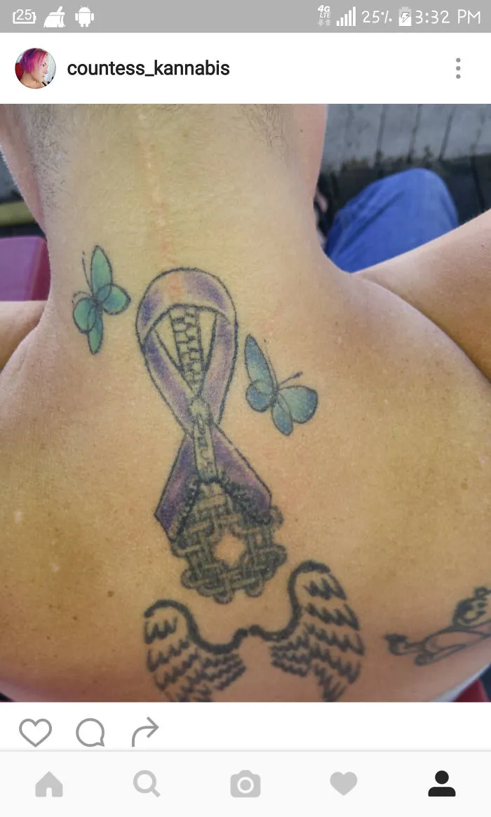 Tattoo art transforming a neck scar into a design with butterflies, a zipper, and wings.