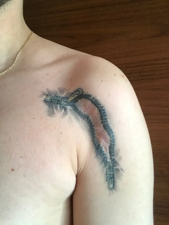 Zipper tattoo on shoulder transforming a scar into a work of art.