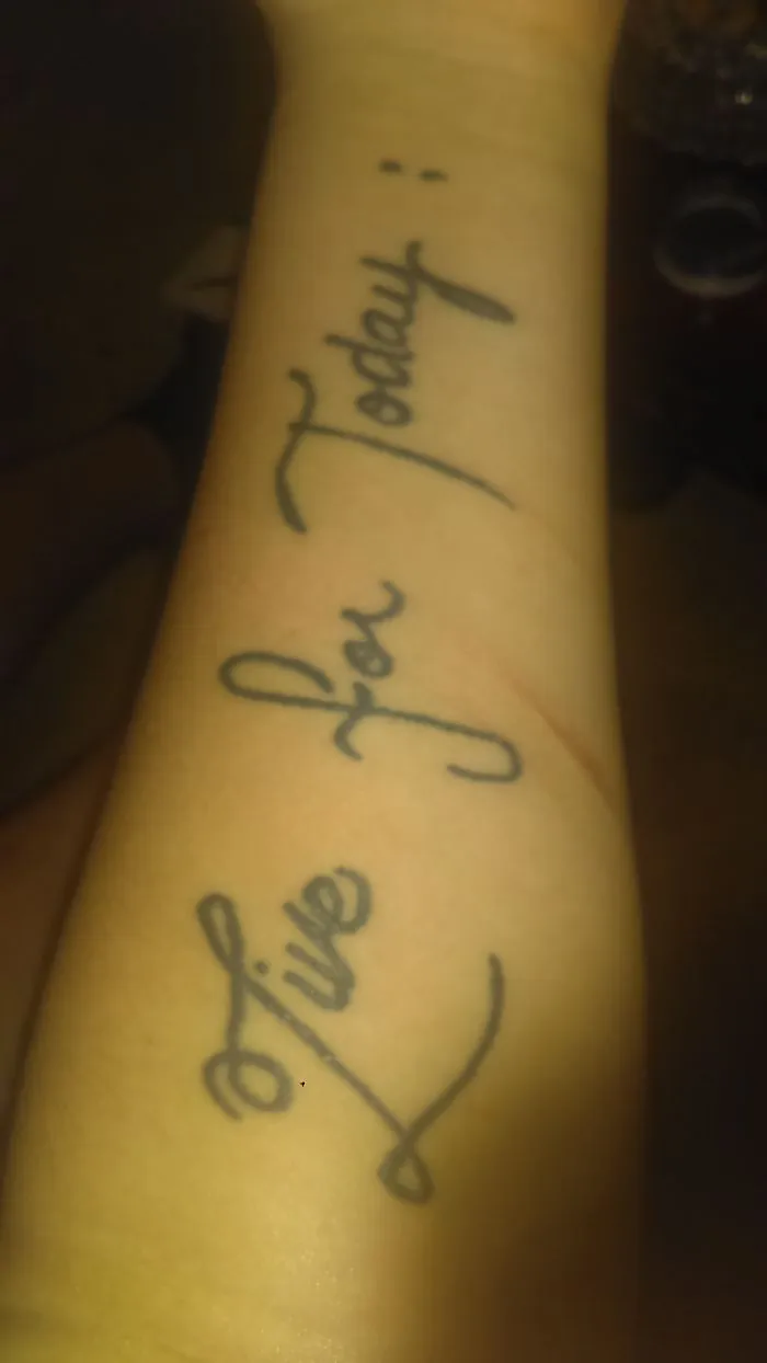 Tattoo on arm turning scar into art with "Live for Today" script.