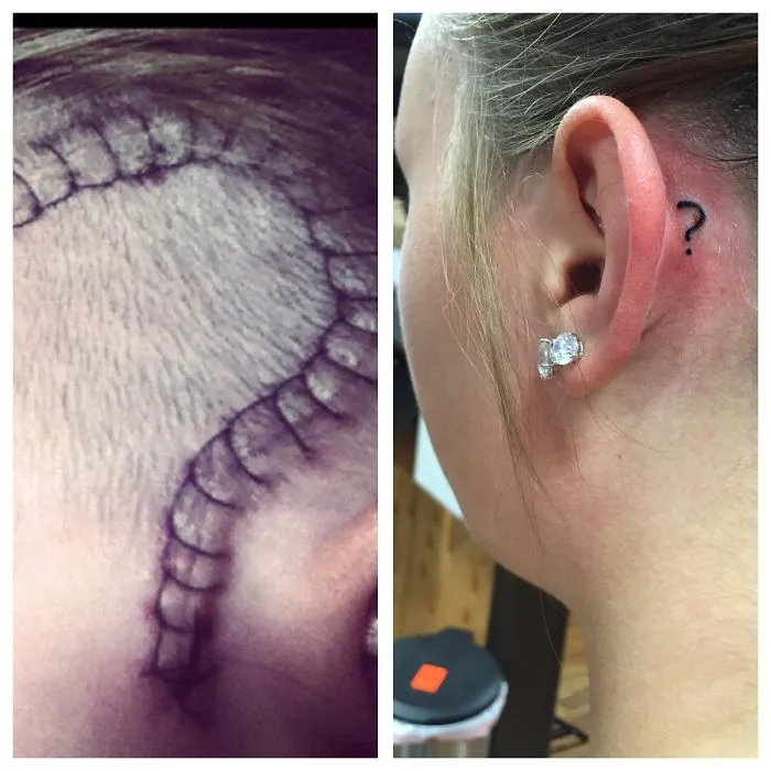 Tattoo art turns a scar into a spine design and a question mark near an ear piercing for creative scar transformation.