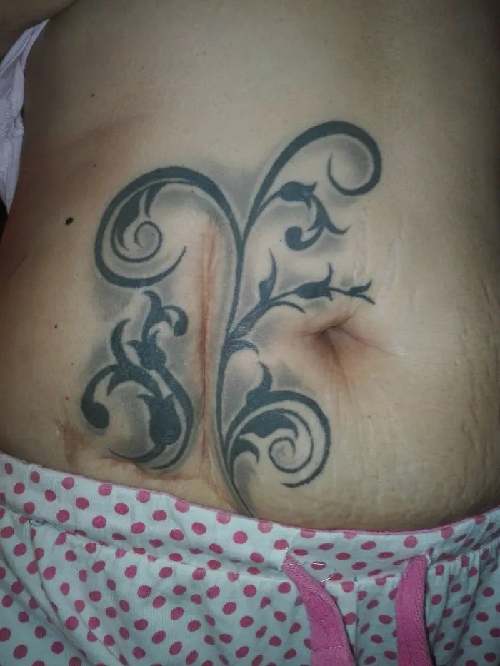 Floral tattoo design beautifully integrates with abdominal scar.