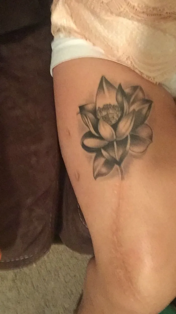 Tattoo art of a lotus flower creatively covering a scar on a thigh.