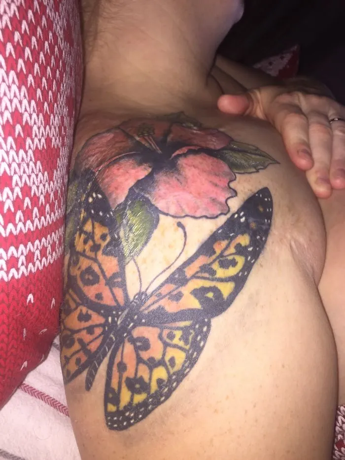 Butterfly and flower tattoo art creatively covers a scar on a person's shoulder.