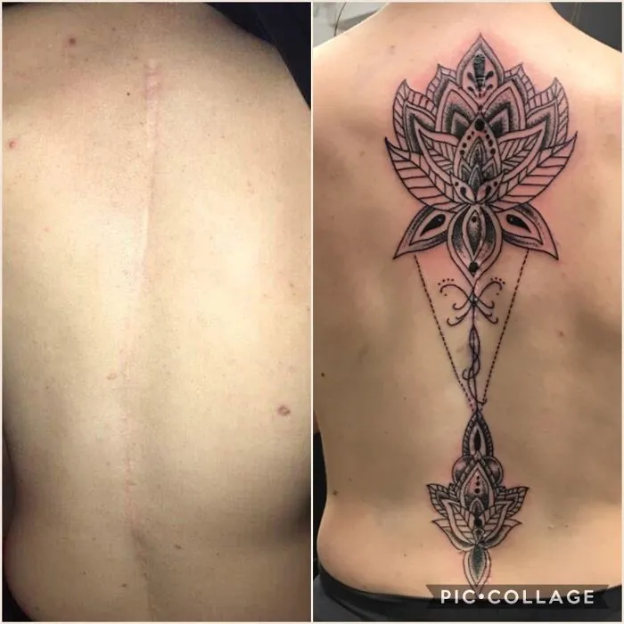 Tattoo transforming a back scar into beautiful art with intricate floral design.