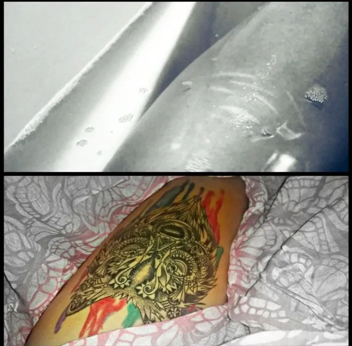 Tattoo art transforming a scar into a colorful design on a person's leg.