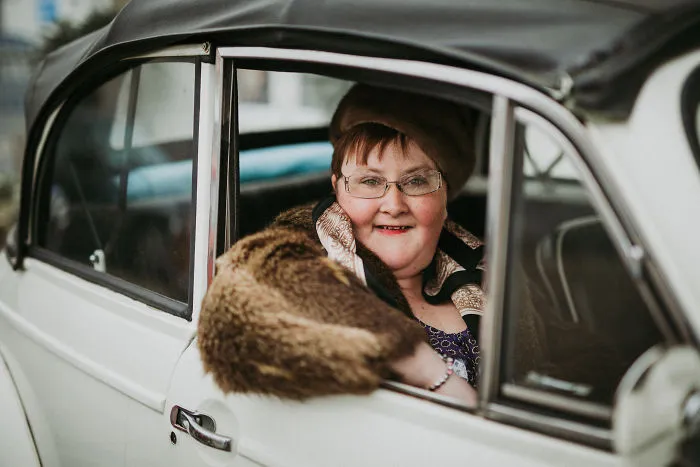 This Is Me: We Photographed People Beyond Their Disabilities