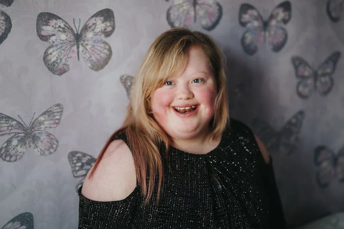 This Is Me: We Photographed People Beyond Their Disabilities