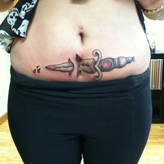 Tattoo of a dagger design creatively covering a scar on a person's abdomen, turning scars into art.