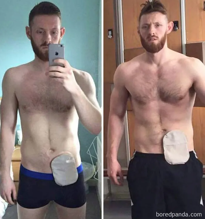 After Having 3 Surgeries, I Finally Got Back To Doing What I Love... Back In The Gym And Playing Football. One Month Apart