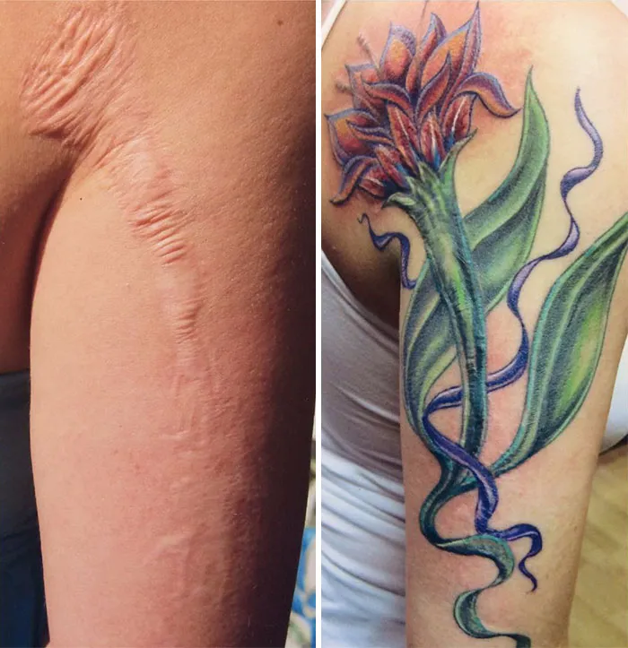 Tattoo covering scar with floral design, transforming it into art on an arm.