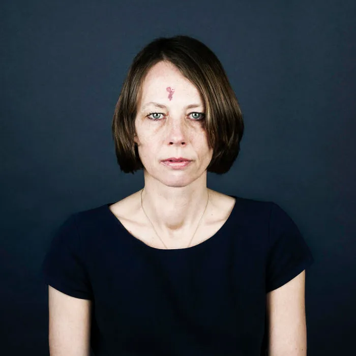 19 Portraits Of People With Birthmarks That Might Change The Way You See Them