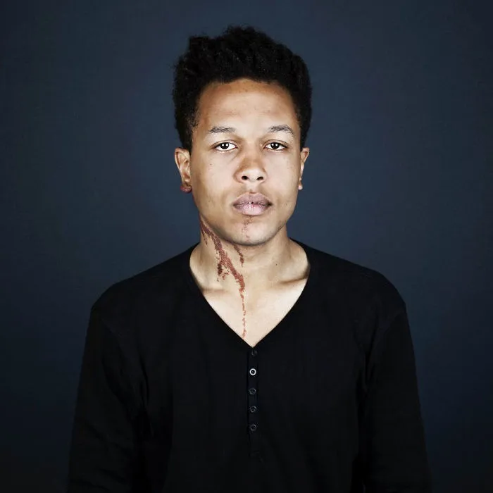 19 Portraits Of People With Birthmarks That Might Change The Way You See Them