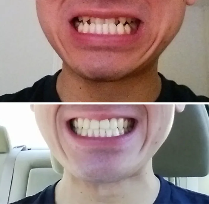 Tras 2 años y medio