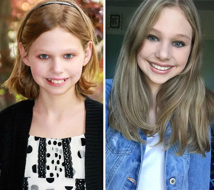 Gracias al aparato y a la pubertad por esta transformación
