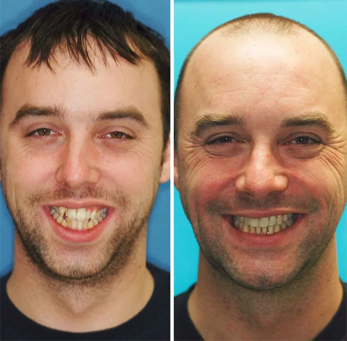 Sonrisa transformada