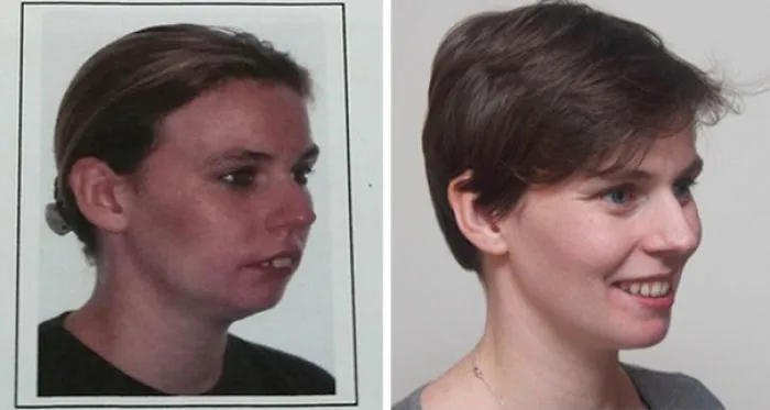 3 años de diferencia