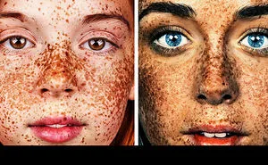 This Photographer Amazingly Captures The Uniqueness Of Exposed Faces