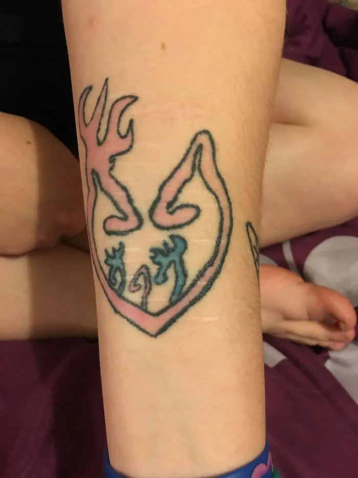 Tattoo art on skin creatively covering scars with colorful design.