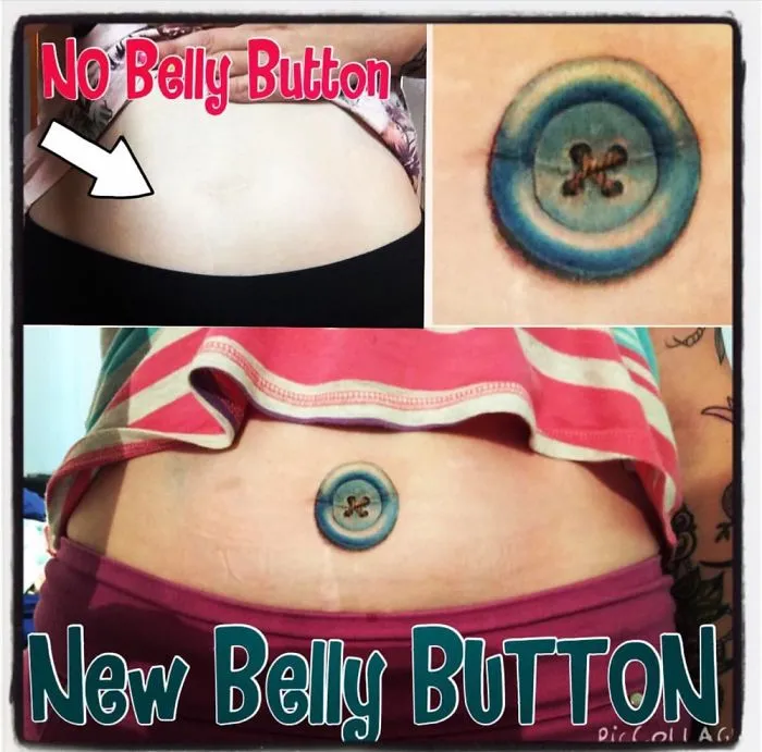 Tattoo art transforms a scar into a blue button design on the abdomen.