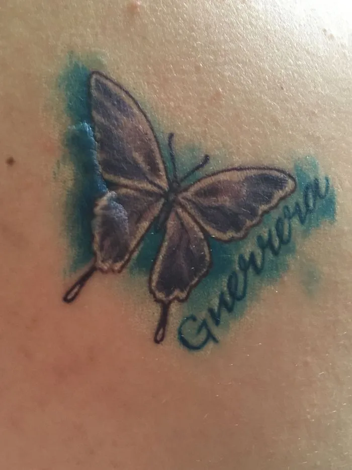 Butterfly tattoo covering a scar, turning it into art.