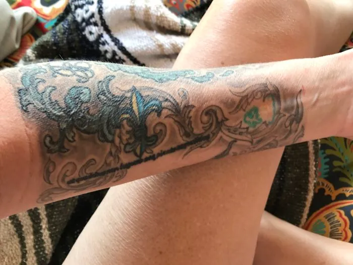 Decorative tattoo art covers an arm scar, enhancing its appearance with intricate designs.