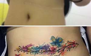 211 Amazing Tattoos That Turn Scars Into Works Of Art