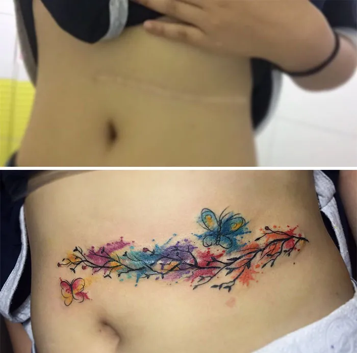 Scars Tattoo Cover Up