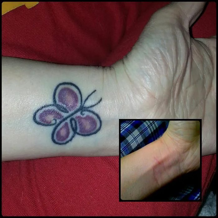 Butterfly tattoo transforming a scar into art on a person's wrist.