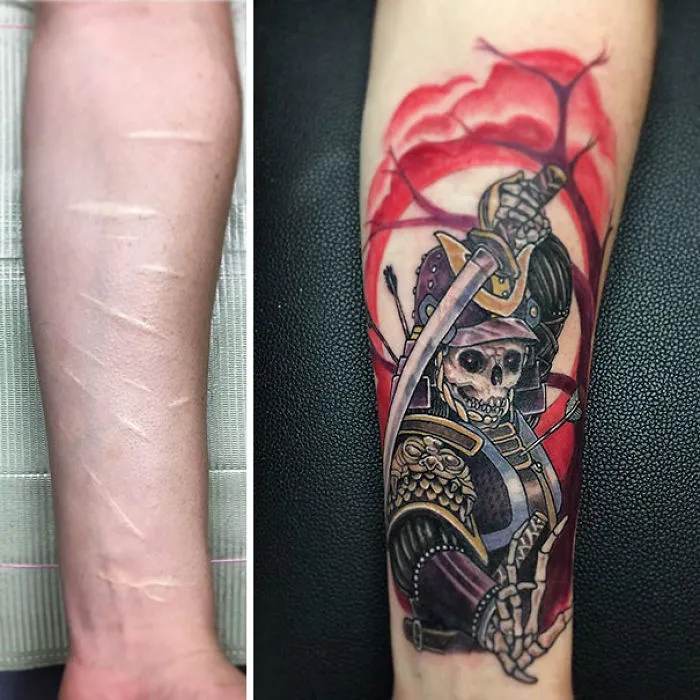 Tattoo transforming scars into art; left: scars on forearm, right: vibrant samurai tattoo over scars.