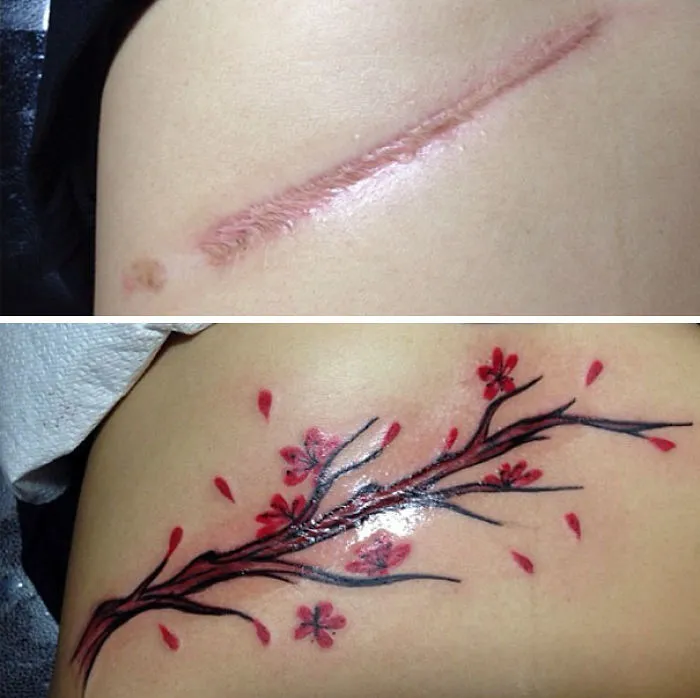 Tattoo art transforming a scar into a cherry blossom design.