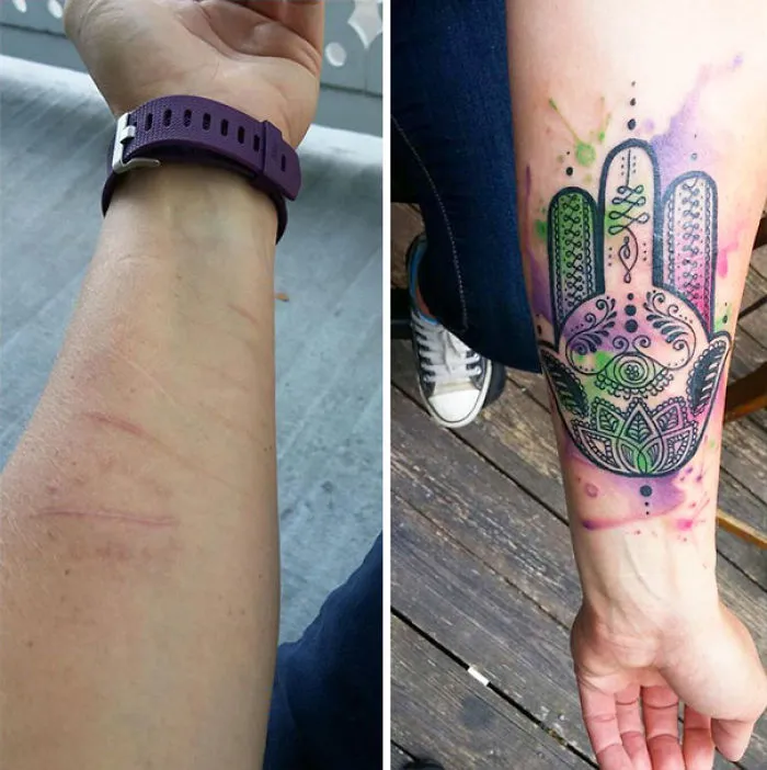 Tattoos transforming scars into colorful art on forearm with intricate mandala design.