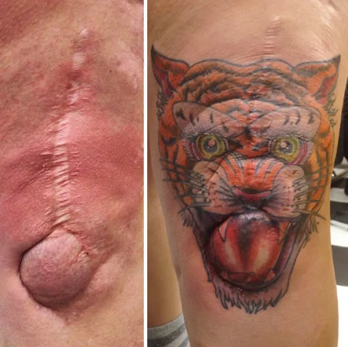 Scar transformed into a colorful tiger tattoo, turning a healed wound into amazing art.