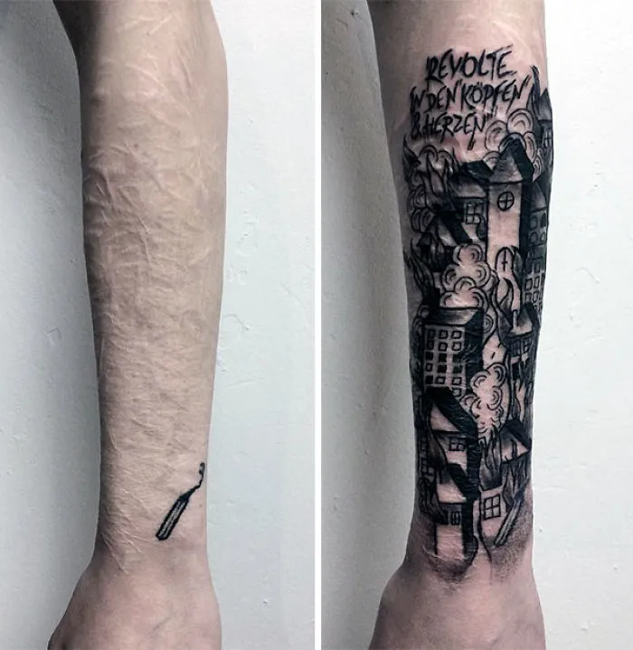 Tattoo art transforms arm scars into a striking cityscape design.