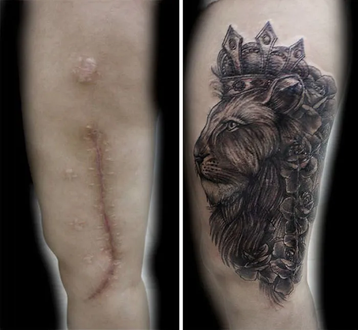 Lion tattoo turning a long scar on an arm into art, symbolizing transformation and creativity in scar tattoos.