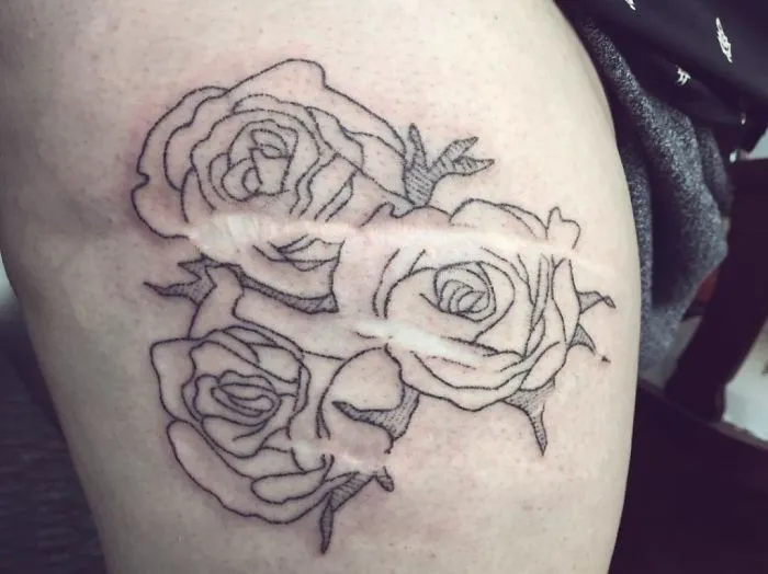Tattoo of roses creatively incorporates a scar, turning it into art.