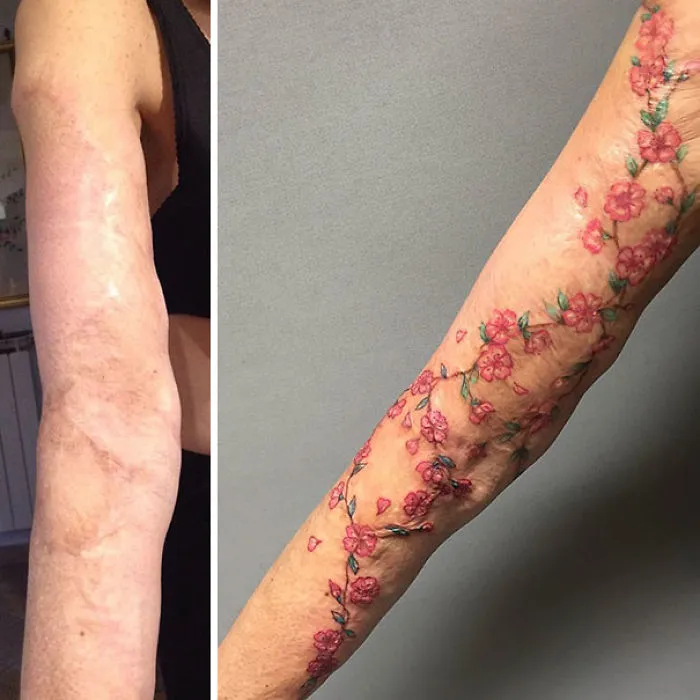 211 Amazing Tattoos That Turn Scars Into Works Of Art