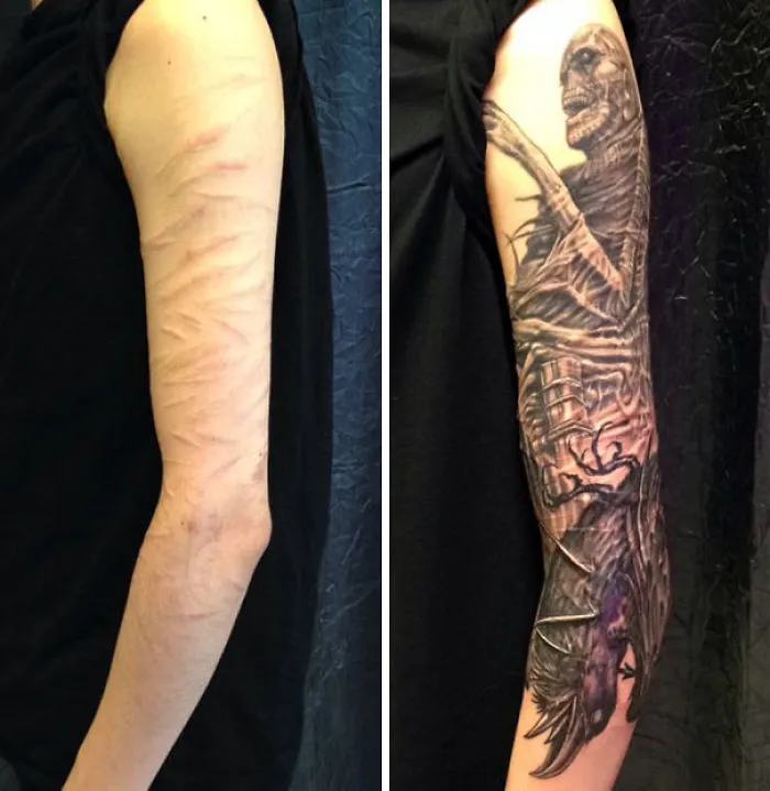 Tattoo transforms arm scars into a stunning skeletal design art piece.