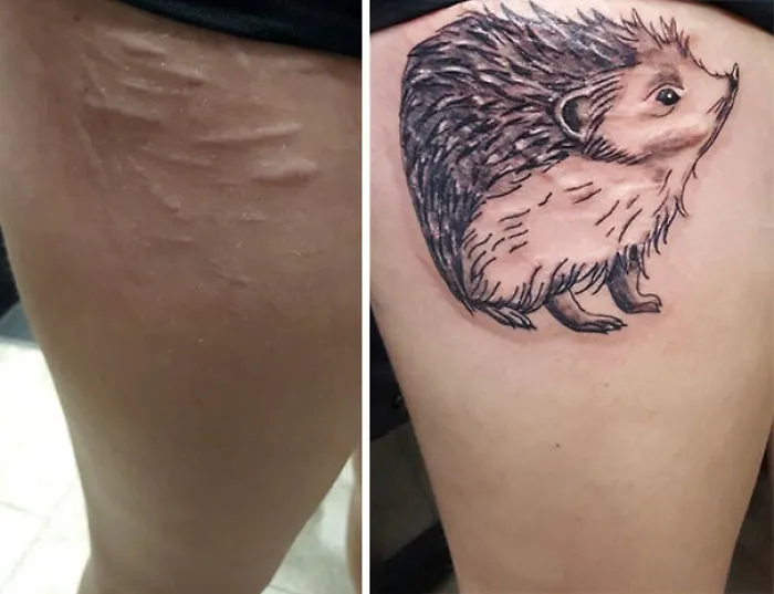 211 Amazing Tattoos That Turn Scars Into Works Of Art