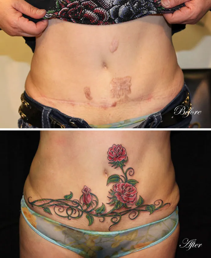 Before and after image of a scar transformed into a floral tattoo.