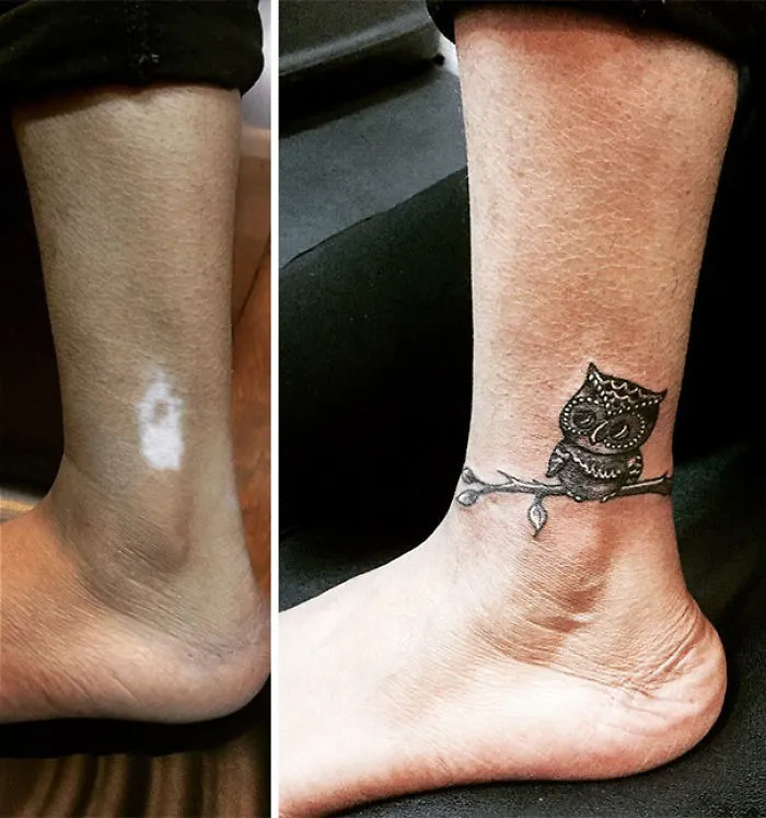 Tattoo art transforming a scar into an owl design on an ankle, showcasing creative and amazing tattoo transformations.