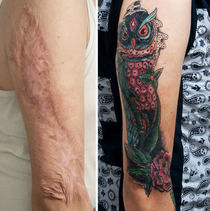 Tattoo transforming a scar into vibrant owl art on an arm.