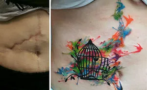211 Amazing Tattoos That Turn Scars Into Works Of Art