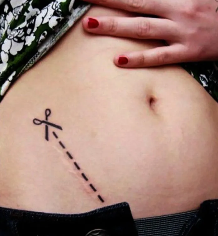 10+ Increíbles tatuajes que convierten cicatrices en obras de arte